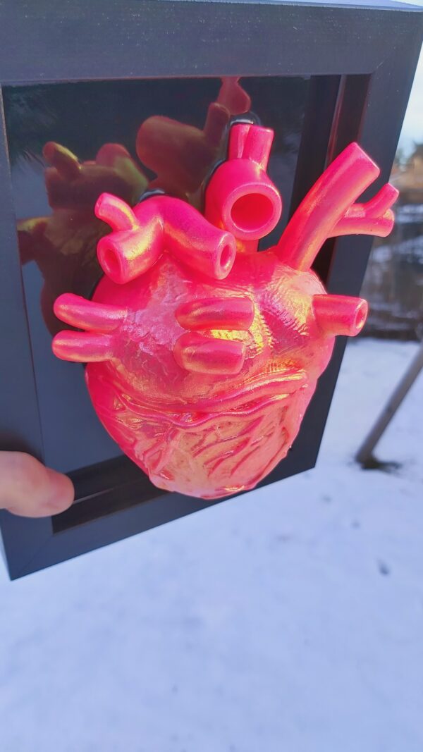 Anatomical Heart - Image 4